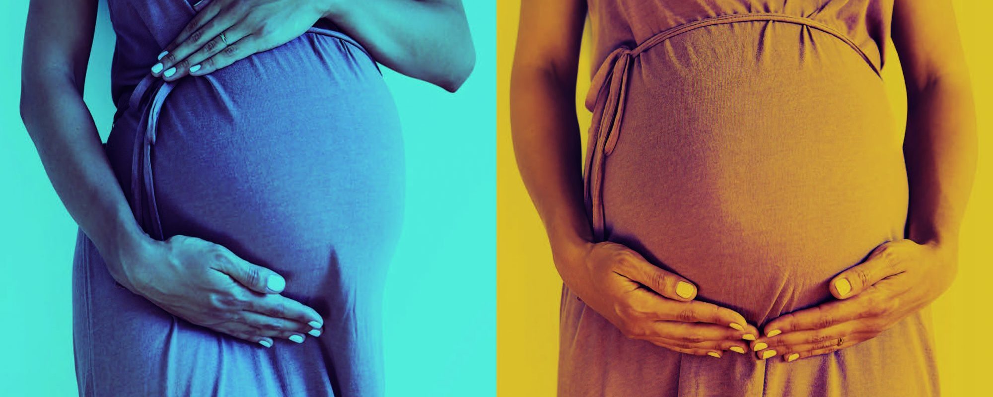 A Tale of Two Pregnancies | Rheumatoid Arthritis (RA)